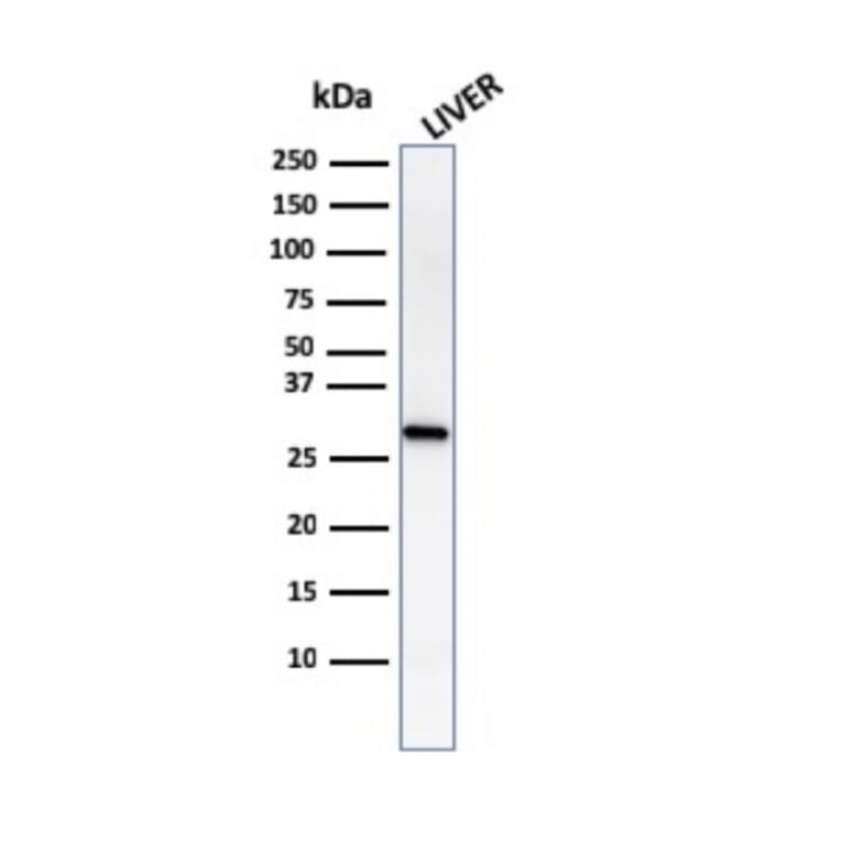 Western Blot - Anti-Prohibitin Antibody [PHB/1882] (A249624) - Antibodies.com