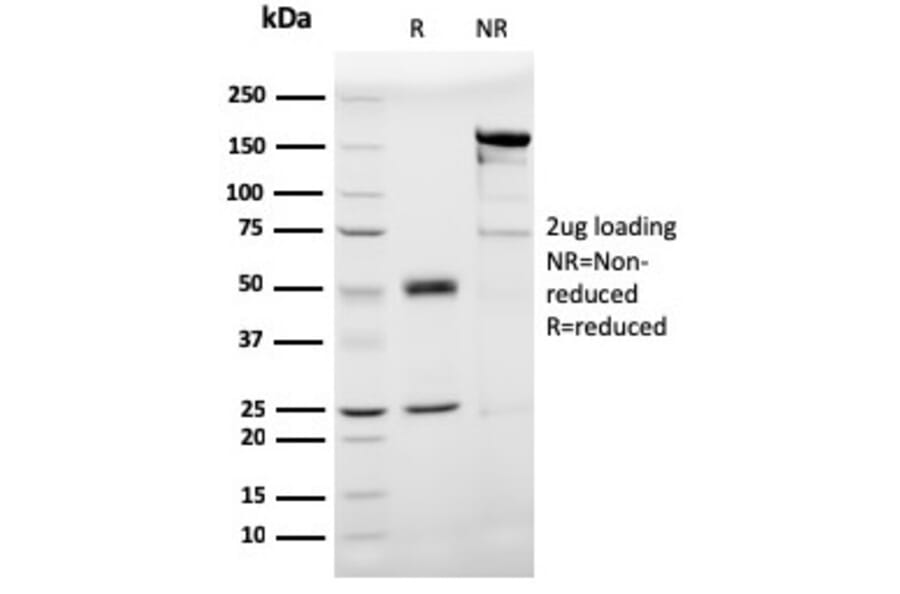 SDS-PAGE - Anti-Prohibitin Antibody [PHB/3193] (A249625) - Antibodies.com
