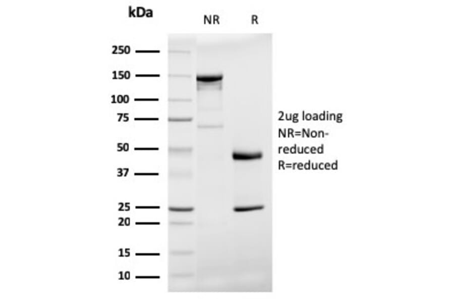 SDS-PAGE - Anti-Prohibitin Antibody [PHB/3194] (A249626) - Antibodies.com