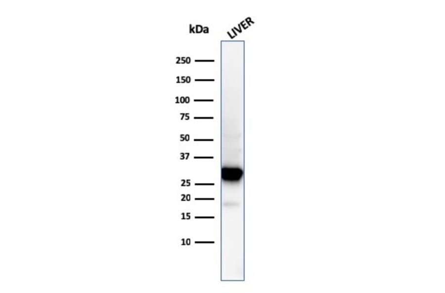 Western Blot - Anti-Prohibitin Antibody [PHB/3194] (A249626) - Antibodies.com