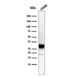 Western Blot - Anti-Prohibitin Antibody [PHB/3194] (A249626) - Antibodies.com