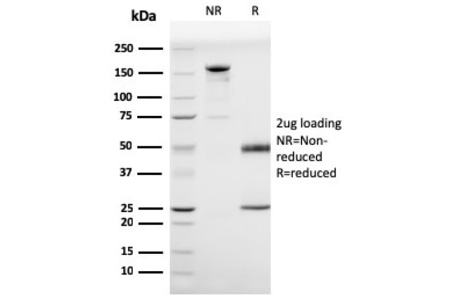 SDS-PAGE - Anti-Prohibitin Antibody [PHB/3225] (A249627) - Antibodies.com