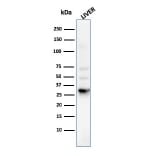 Western Blot - Anti-Prohibitin Antibody [PHB/3225] (A249627) - Antibodies.com