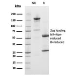 SDS-PAGE - Anti-Prohibitin Antibody [PHB/3226] (A249628) - Antibodies.com