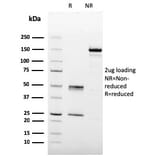 SDS-PAGE - Anti-Prohibitin Antibody [PHB/3227] (A249629) - Antibodies.com
