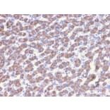 Immunohistochemistry - Anti-Prohibitin Antibody [PHB/3228] (A249630) - Antibodies.com