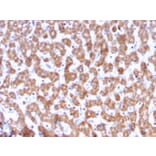 Immunohistochemistry - Anti-Prohibitin Antibody [PHB/3228] (A249630) - Antibodies.com