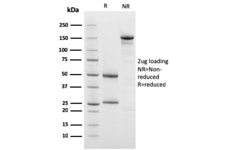 SDS-PAGE - Anti-Prohibitin Antibody [PHB/3228] (A249630) - Antibodies.com