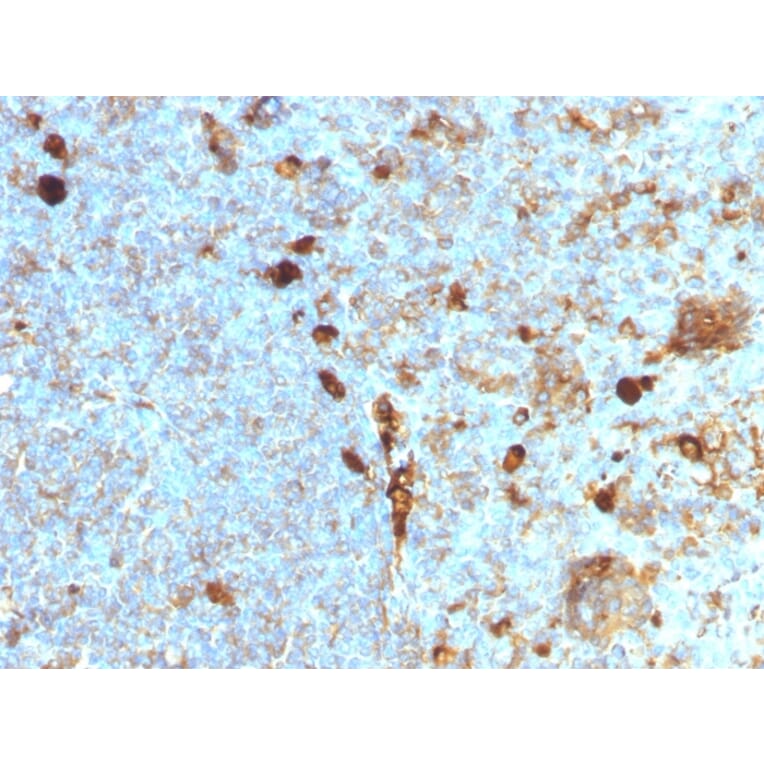 Immunohistochemistry - Anti-alpha 1 Antitrypsin Antibody [AAT/1378] (A249631) - Antibodies.com