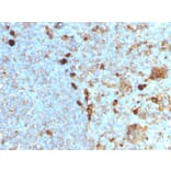 Immunohistochemistry - Anti-alpha 1 Antitrypsin Antibody [AAT/1378] (A249631) - Antibodies.com