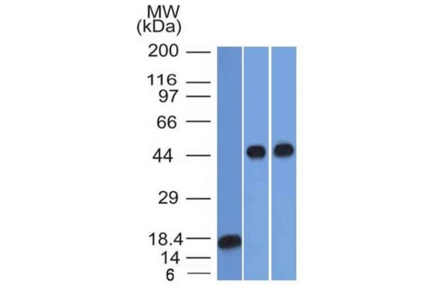 Western Blot - Anti-alpha 1 Antitrypsin Antibody [AAT/1378] (A249632) - Antibodies.com