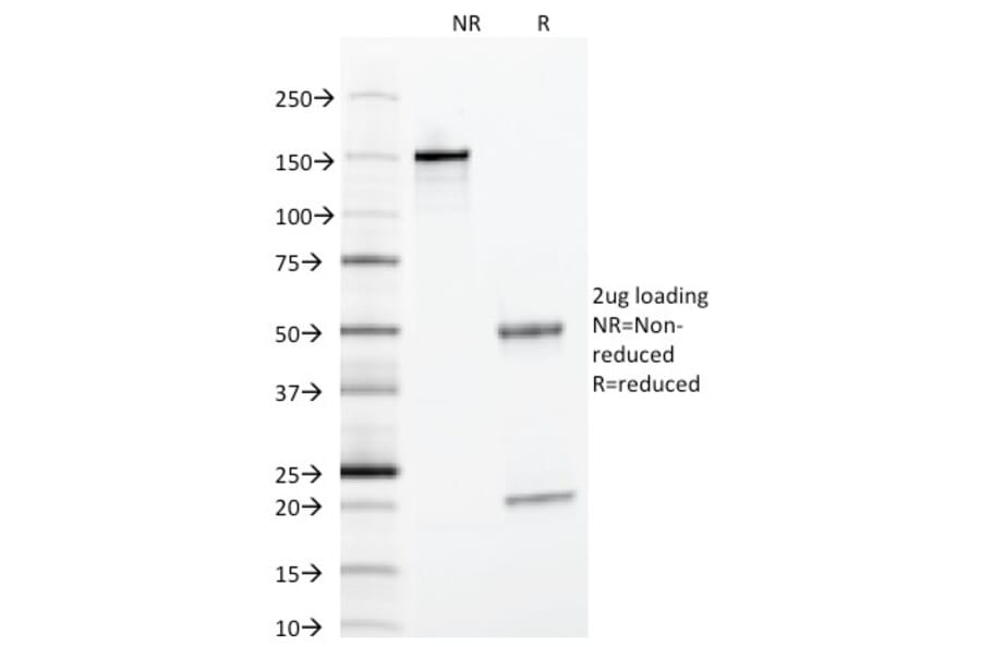 SDS-PAGE - Anti-alpha 1 Antitrypsin Antibody [AAT/1378] (A249632) - Antibodies.com