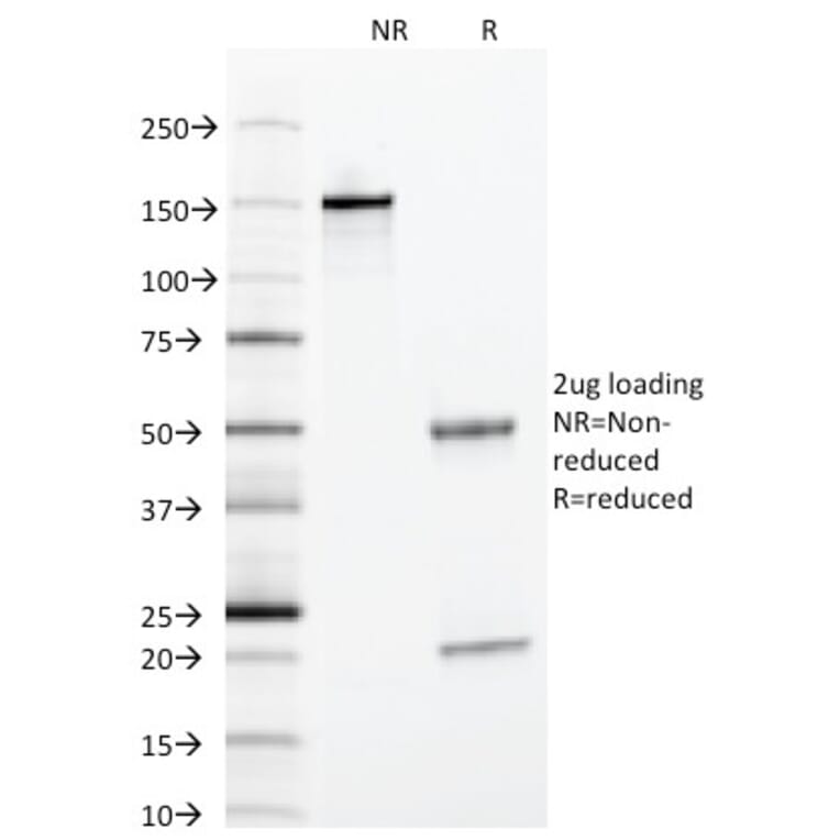 SDS-PAGE - Anti-alpha 1 Antitrypsin Antibody [AAT/1378] (A249632) - Antibodies.com