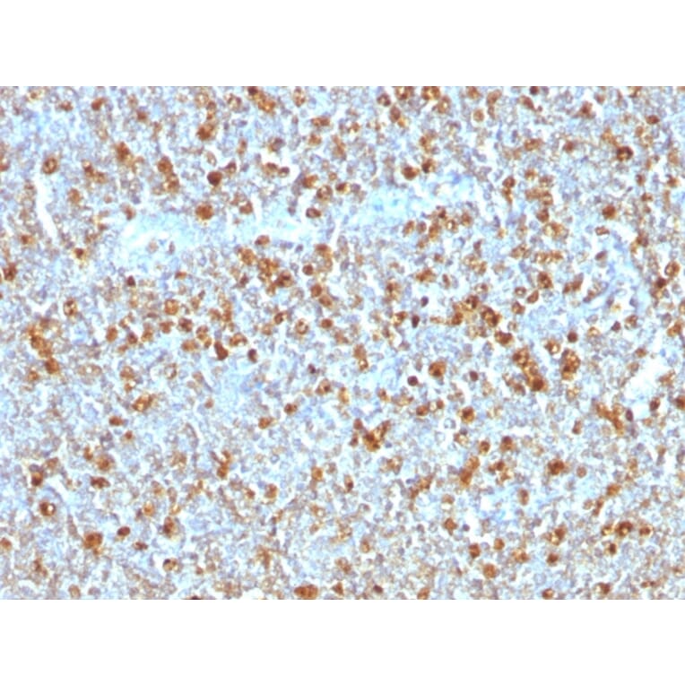 Immunohistochemistry - Anti-alpha 1 Antitrypsin Antibody [AAT/1379] (A249632) - Antibodies.com