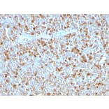 Immunohistochemistry - Anti-alpha 1 Antitrypsin Antibody [AAT/1379] (A249632) - Antibodies.com