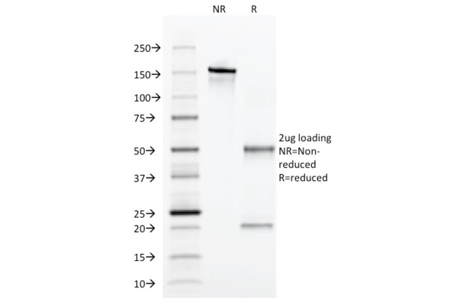 SDS-PAGE - Anti-alpha 1 Antitrypsin Antibody [AAT/1379] (A249633) - Antibodies.com