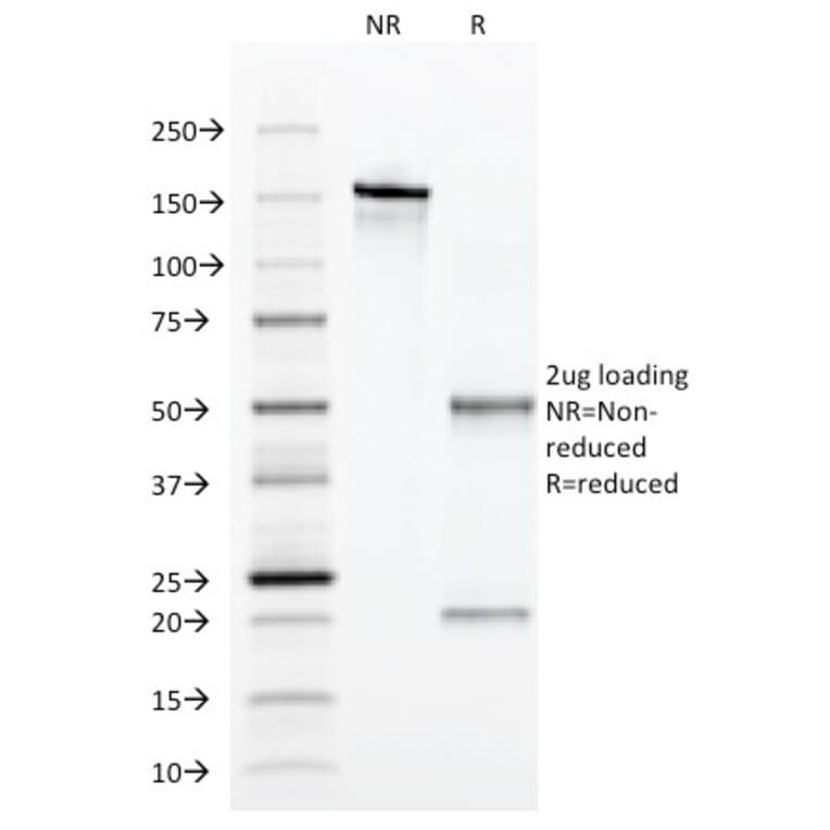 SDS-PAGE - Anti-alpha 1 Antitrypsin Antibody [AAT/1379] (A249633) - Antibodies.com