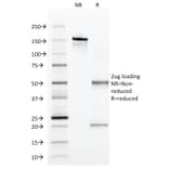 SDS-PAGE - Anti-alpha 1 Antitrypsin Antibody [AAT/1379] (A249633) - Antibodies.com