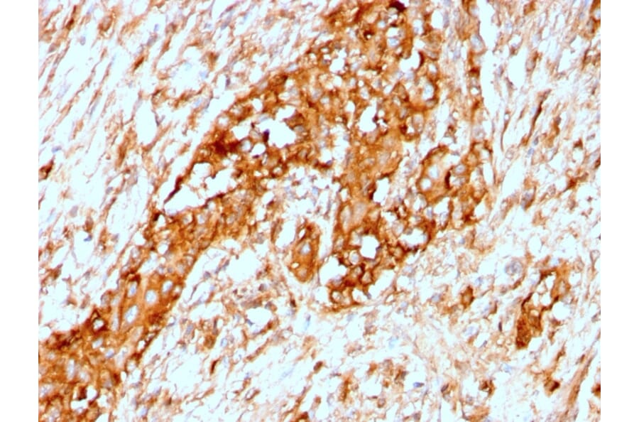 Immunohistochemistry - Anti-alpha 1 Antitrypsin Antibody [AAT/3167R] (A249633) - Antibodies.com