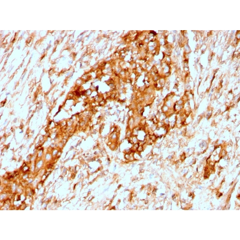 Immunohistochemistry - Anti-alpha 1 Antitrypsin Antibody [AAT/3167R] (A249633) - Antibodies.com