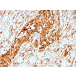 Immunohistochemistry - Anti-alpha 1 Antitrypsin Antibody [AAT/3167R] (A249633) - Antibodies.com