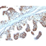 Immunohistochemistry - Anti-PTEN Antibody [PTEN/2110] (A249635) - Antibodies.com