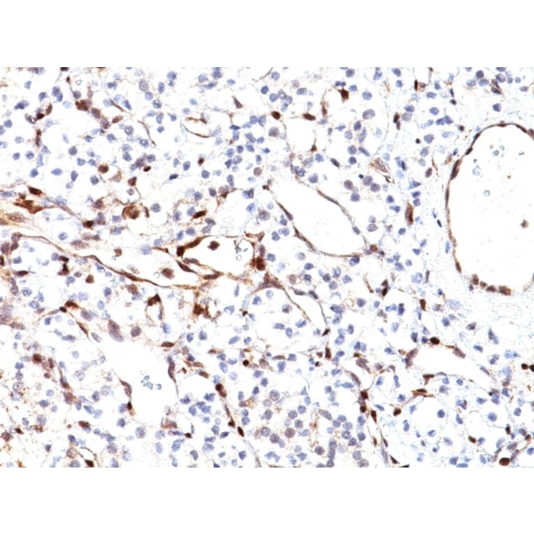 Immunohistochemistry - Anti-PTEN Antibody [PTEN/2110] (A249635) - Antibodies.com