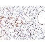 Immunohistochemistry - Anti-PTEN Antibody [PTEN/2110] (A249635) - Antibodies.com