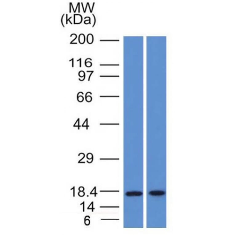 Western Blot - Anti-GCDFP 15 Antibody [PIP/1571] (A249636) - Antibodies.com