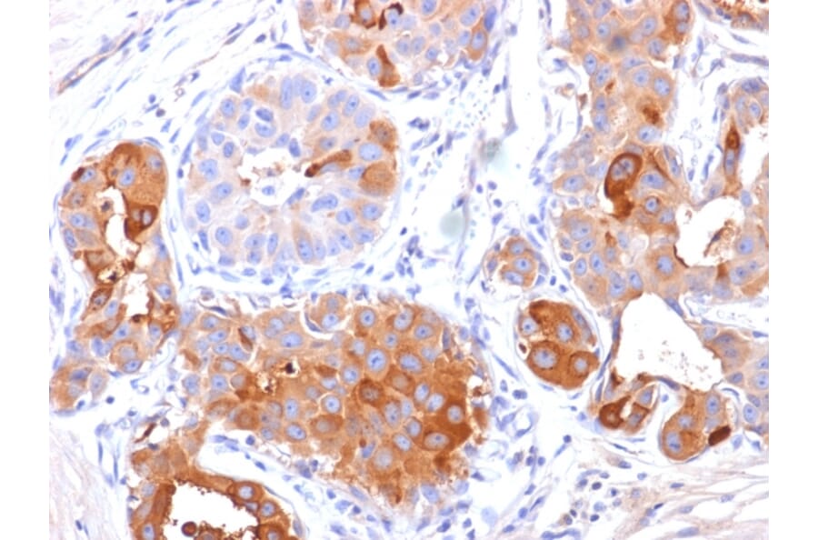 Immunohistochemistry - Anti-GCDFP 15 Antibody [PIP/1571] (A249636) - Antibodies.com
