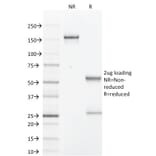 SDS-PAGE - Anti-GCDFP 15 Antibody [PIP/1571] (A249636) - Antibodies.com