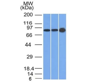 Western Blot - Anti-Plakophilin 1 Antibody [10B2] (A249637) - Antibodies.com
