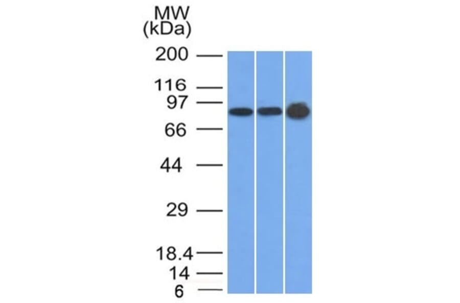 Western Blot - Anti-Plakophilin 1 Antibody [10B2] (A249637) - Antibodies.com