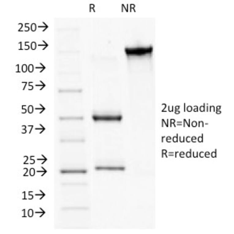 SDS-PAGE - Anti-Plakophilin 1 Antibody [10B2] (A249636) - Antibodies.com