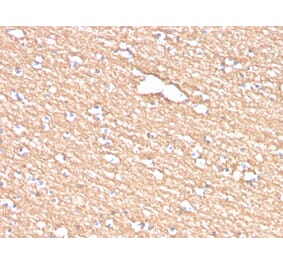 Immunohistochemistry - Anti-Myelin PLP Antibody [PLP1/4259] (A249637) - Antibodies.com