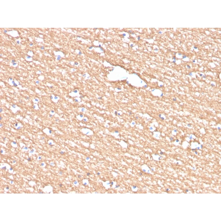 Immunohistochemistry - Anti-Myelin PLP Antibody [PLP1/4259] (A249637) - Antibodies.com