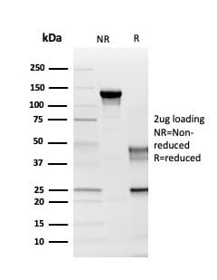 Anti-Myelin PLP Antibody [PLP1/4259] (A249638) | Antibodies.com