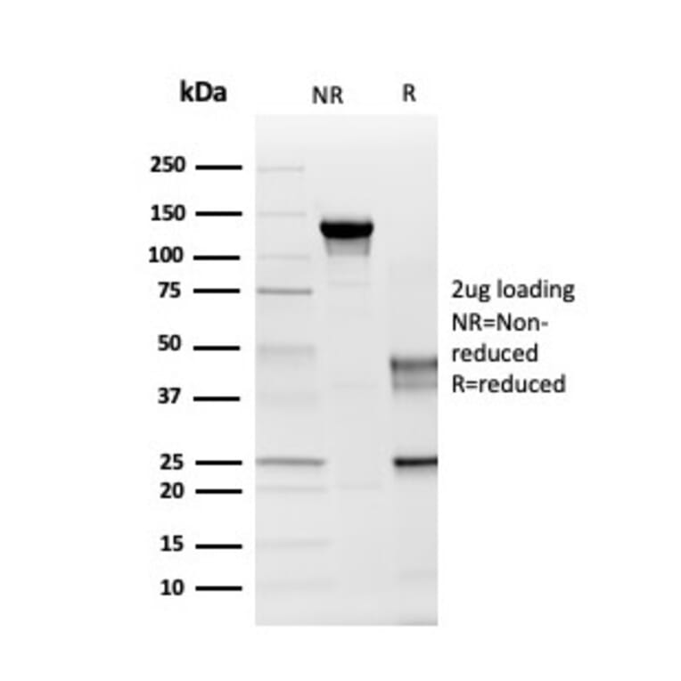 SDS-PAGE - Anti-Myelin PLP Antibody [PLP1/4259] (A249638) - Antibodies.com