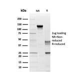 SDS-PAGE - Anti-Myelin PLP Antibody [PLP1/4259] (A249638) - Antibodies.com