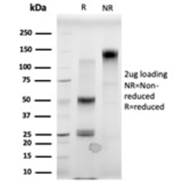 SDS-PAGE - Anti-MBD3 Antibody [PCRP-MBD3-1C4] (A249639) - Antibodies.com