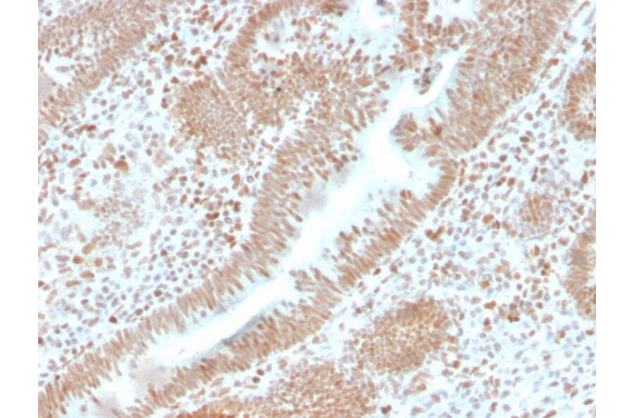 Immunohistochemistry - Anti-PMS2 Antibody [PMS2/4373R] (A249640) - Antibodies.com