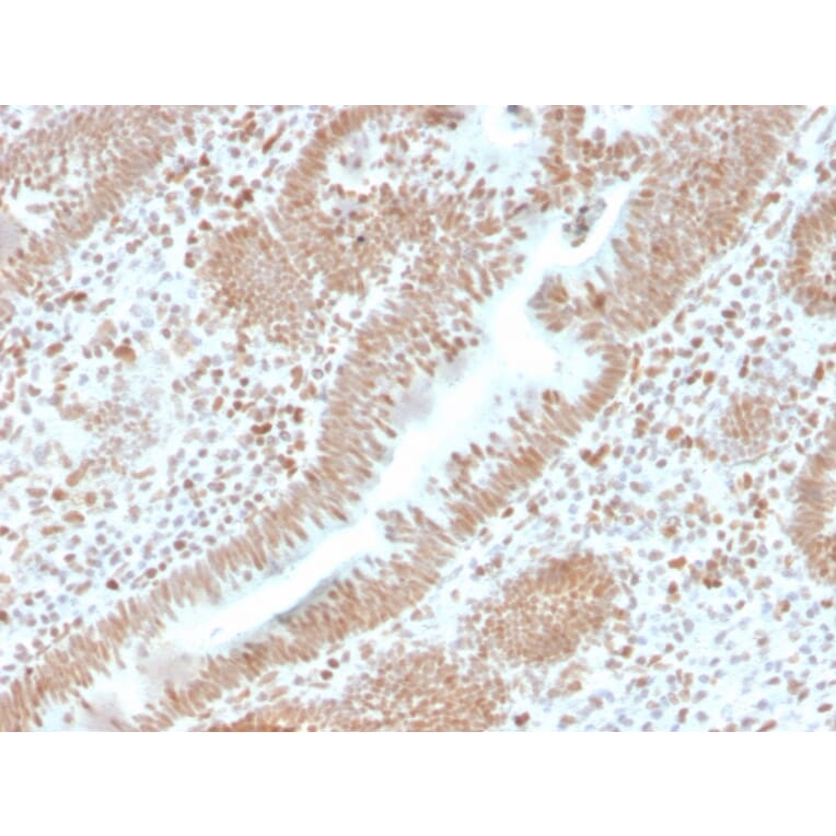 Immunohistochemistry - Anti-PMS2 Antibody [PMS2/4373R] (A249640) - Antibodies.com