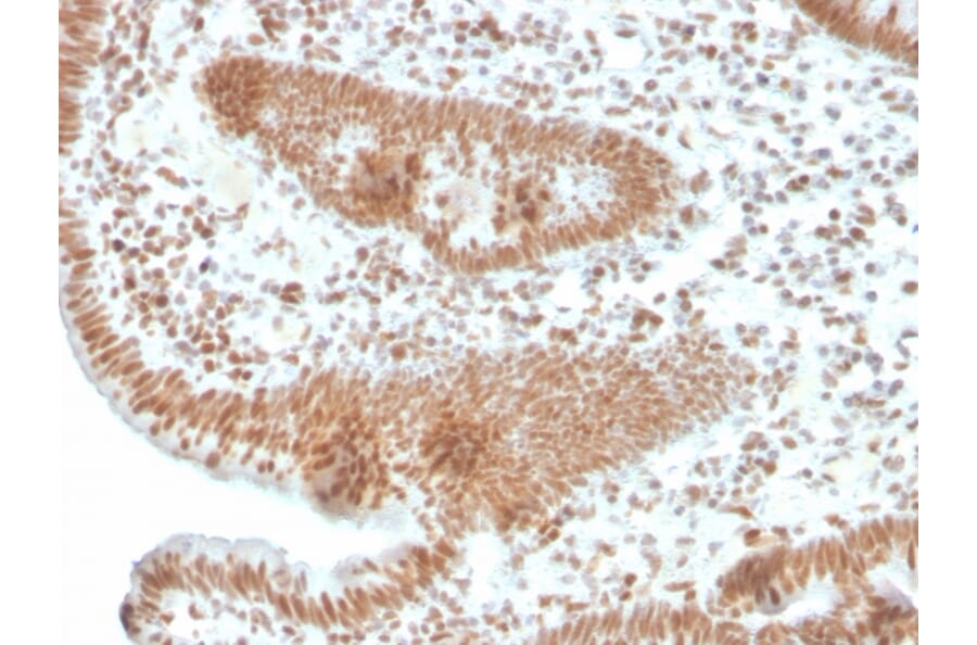 Immunohistochemistry - Anti-PMS2 Antibody [PMS2/4373R] (A249640) - Antibodies.com