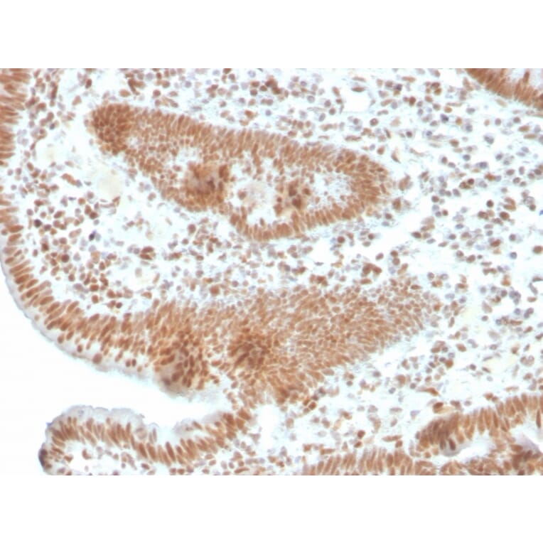 Immunohistochemistry - Anti-PMS2 Antibody [PMS2/4373R] (A249640) - Antibodies.com