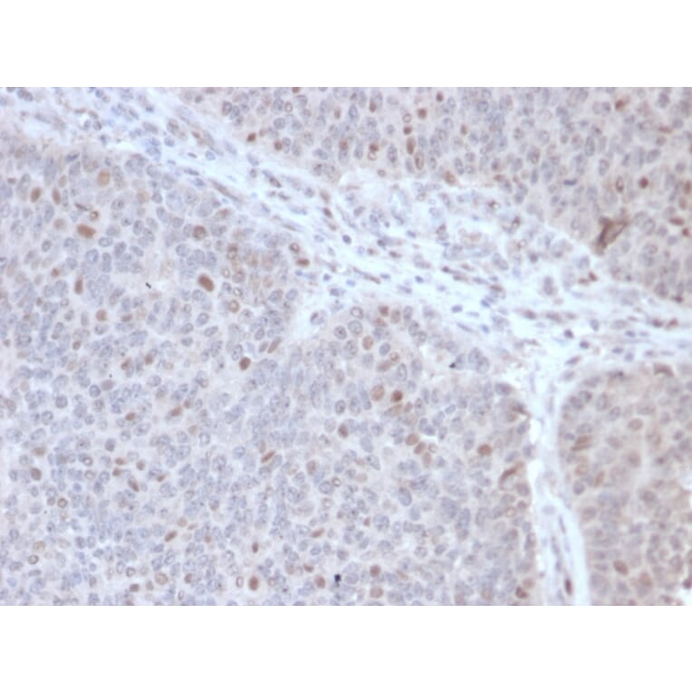 Immunohistochemistry - Anti-CHRAC17 Antibody [PCRP-POLE3-2F10] (A249641) - Antibodies.com
