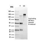 SDS-PAGE - Anti-CHRAC17 Antibody [PCRP-POLE3-2F10] (A249641) - Antibodies.com