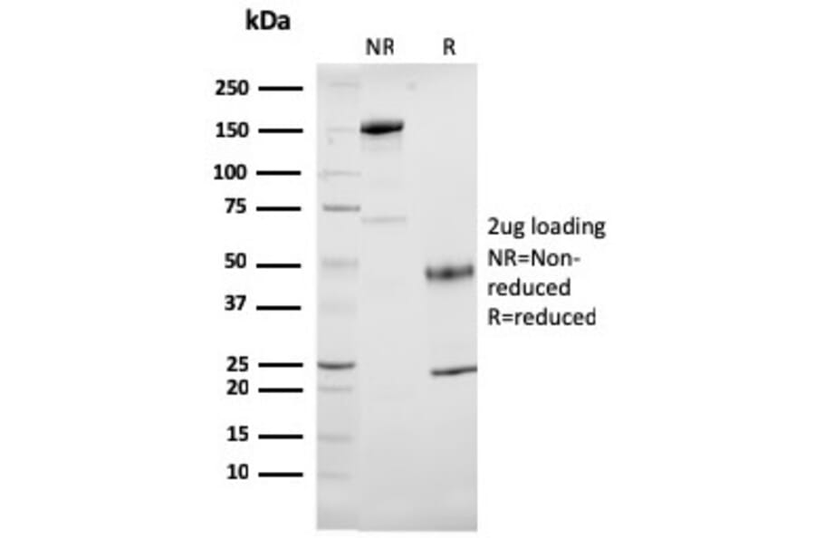 SDS-PAGE - Anti-Cytochrome C Antibody [7H8.2C12] (A249643) - Antibodies.com