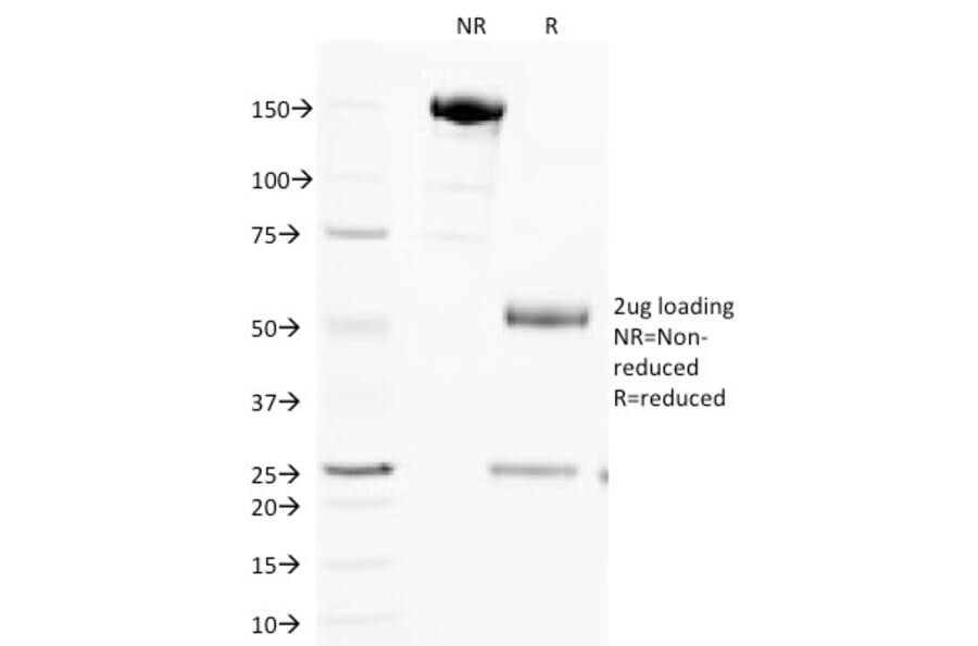 SDS-PAGE - Anti-Cytochrome C Antibody [SPM389] (A249644) - Antibodies.com