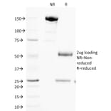 SDS-PAGE - Anti-Cytochrome C Antibody [SPM389] (A249644) - Antibodies.com