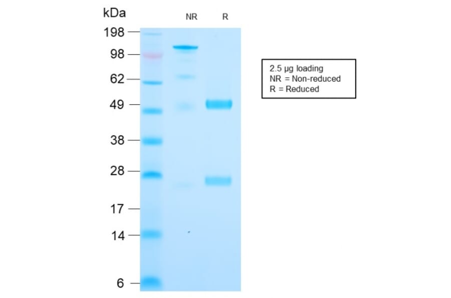 SDS-PAGE - Anti-Cytochrome C Antibody [CYCS/3128R] (A249649) - Antibodies.com